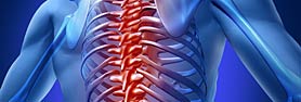 Spinal Cord Injuries